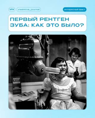 Первый стоматологический рентген — история одного эксперимента.